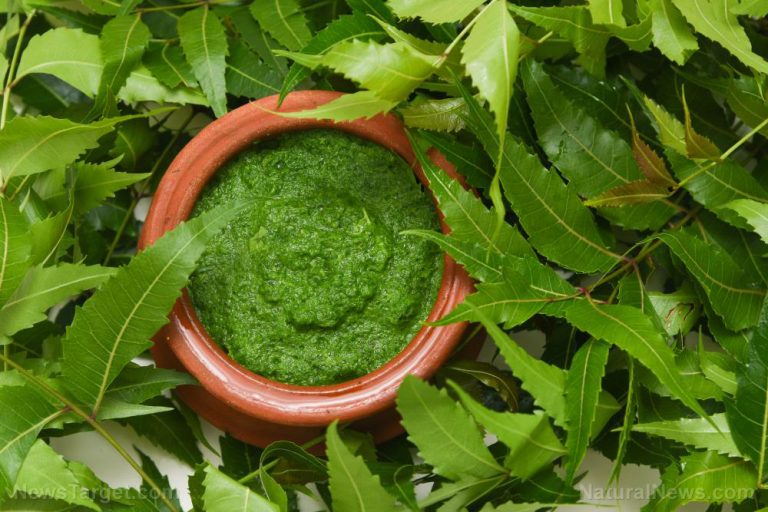 Treat skin conditions like psoriasis with these herbal remedies